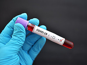 Repositório virtual recebe decisões sobre coronavírus